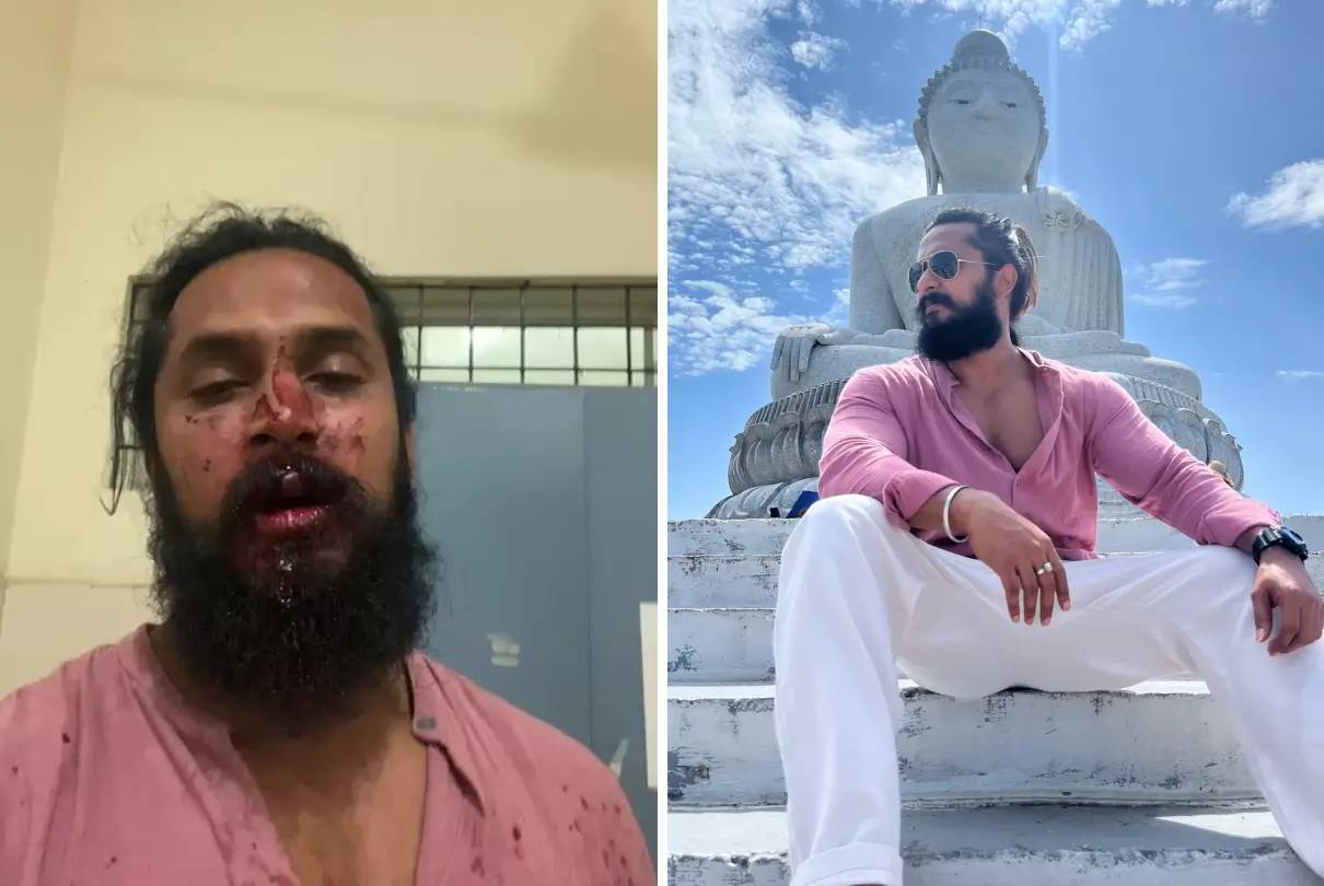 Chetan Chanddrra Endures Brutal Assault by Mob: Kannada Actor Shares Startling Footage of His Injured Face